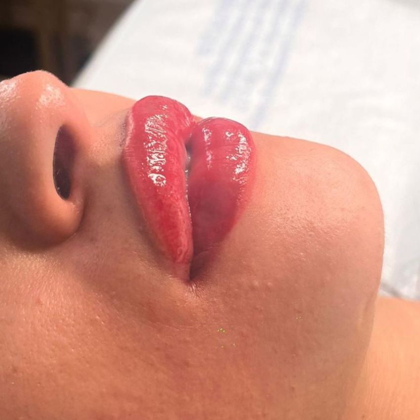 Glaçage des lèvres